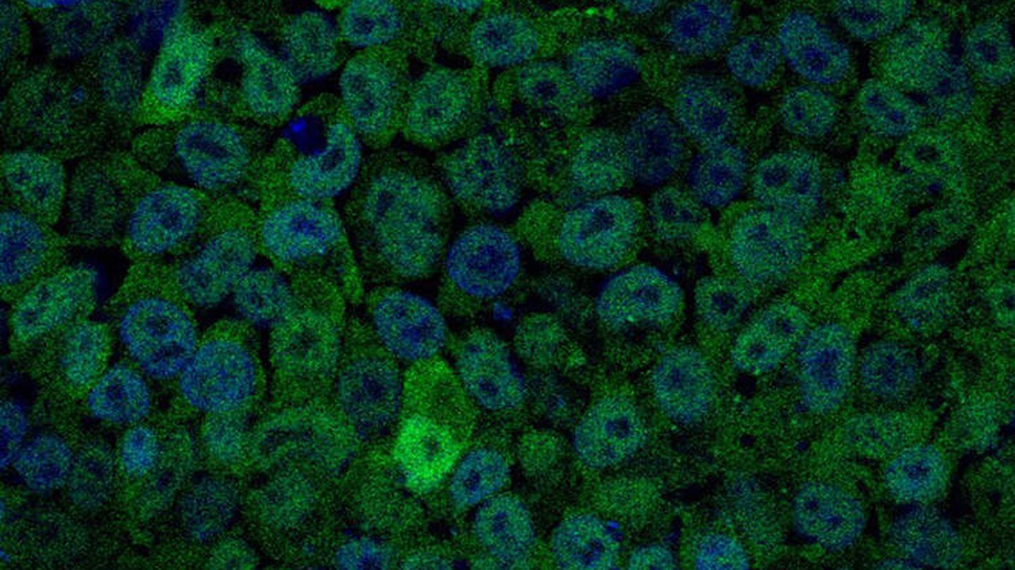 Imagen de células madre embrionarias correspondientes a otra investigación. (CNB-CSIC)