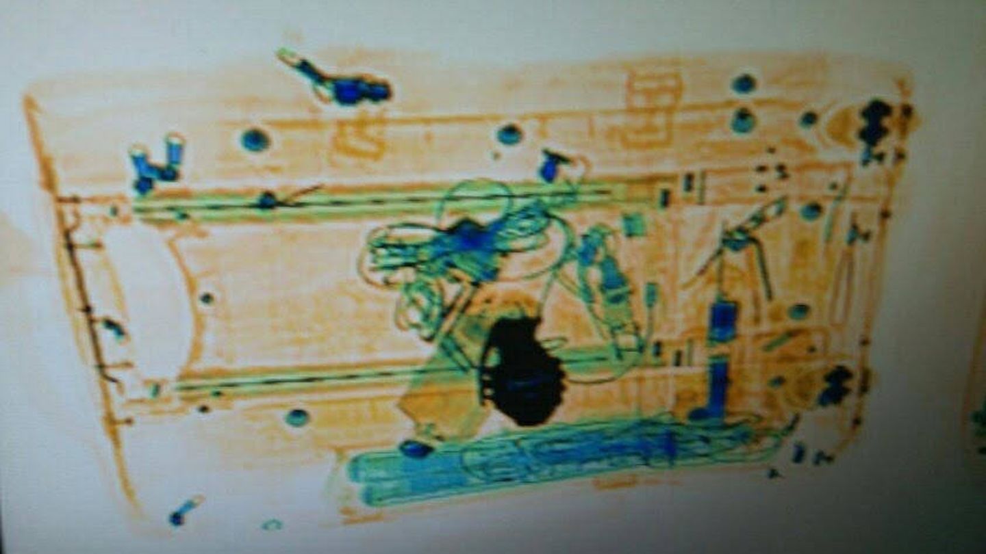 Imagen del escáner en el que se puede ver la supuesta granada. (Mossos)