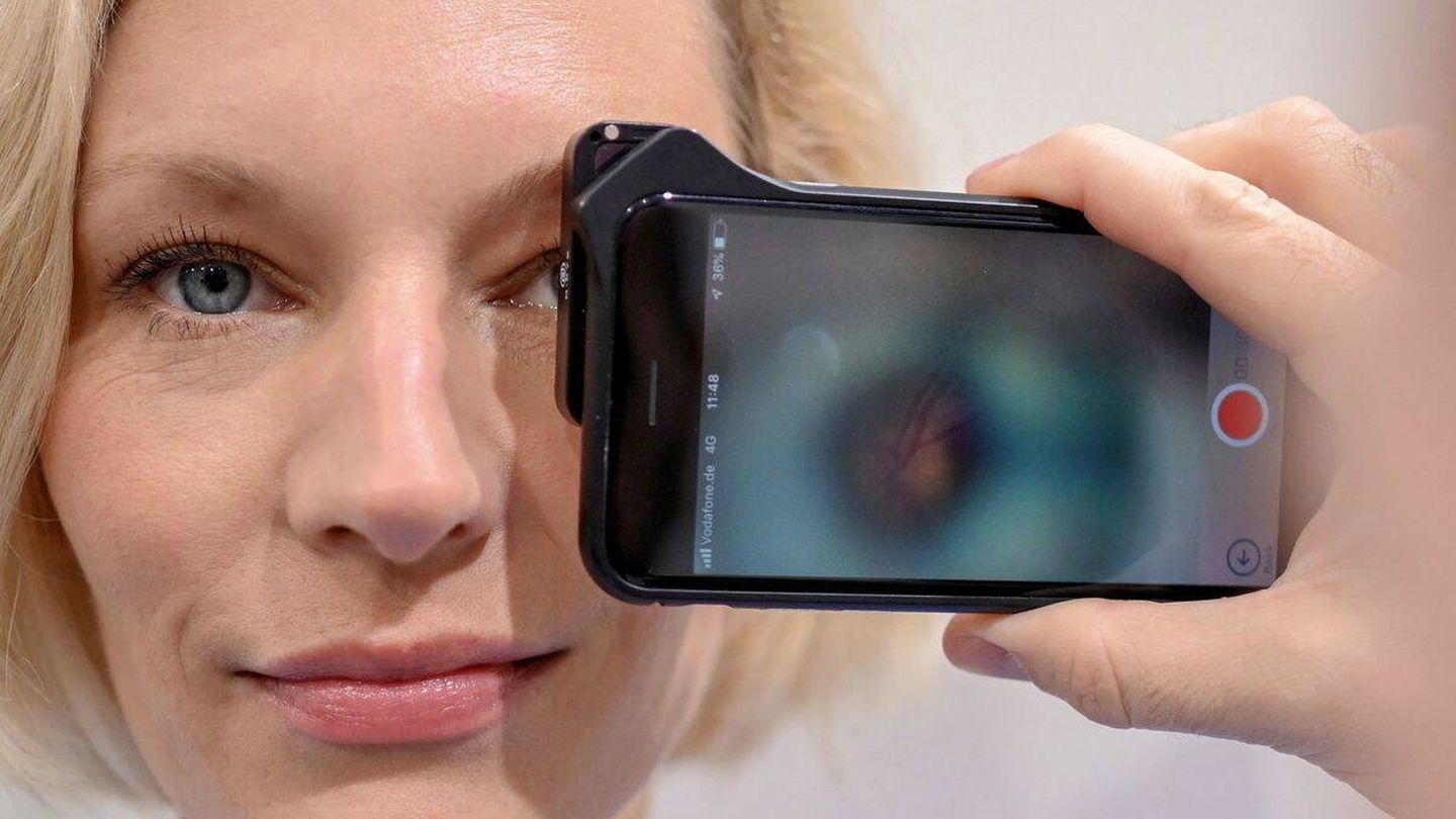 Un examen de retina hecho con un móvil. (EFE)