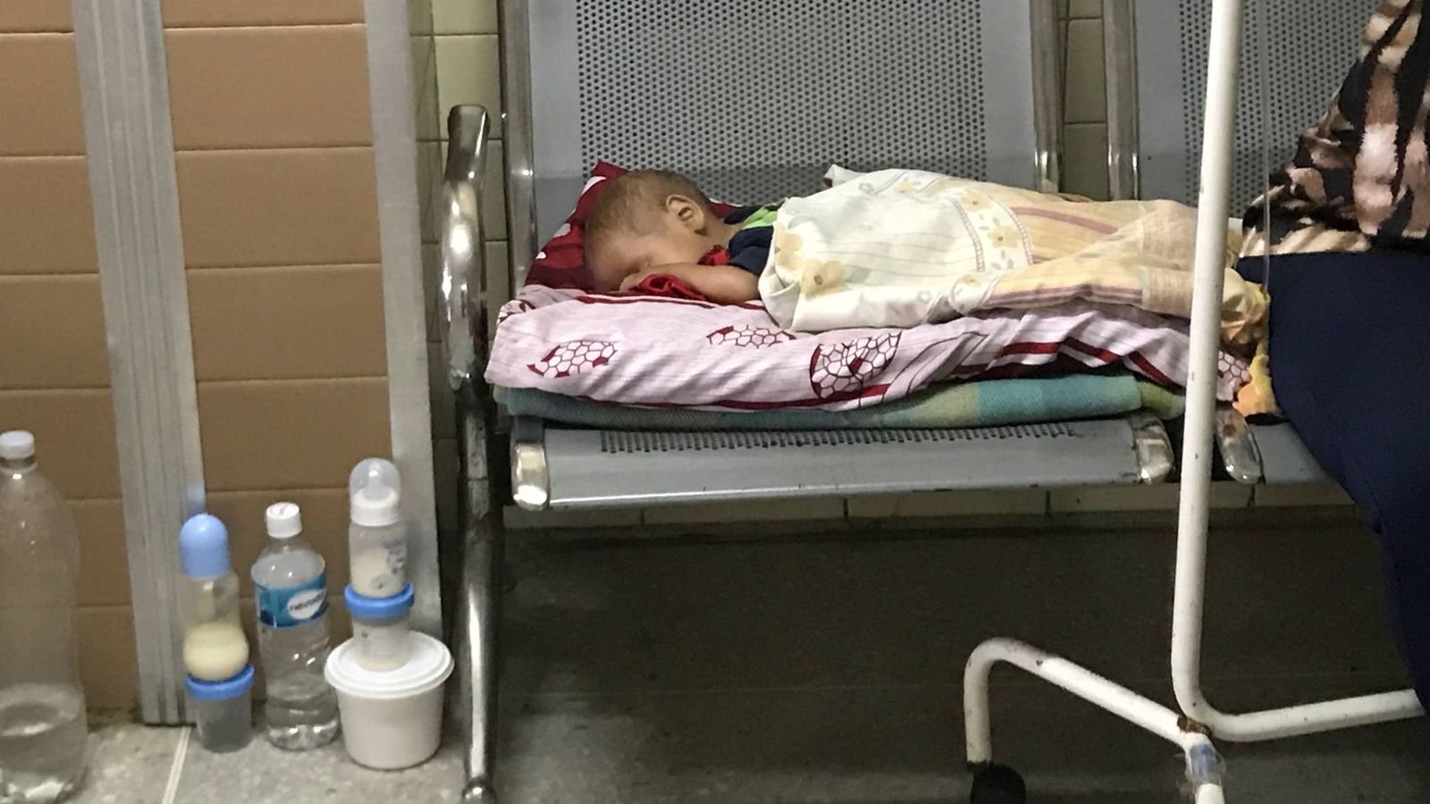 Foto: Un bebé desnutrido en un hospital de Puerto Ordaz, en el Arco del Orinoco (A. Hernández)