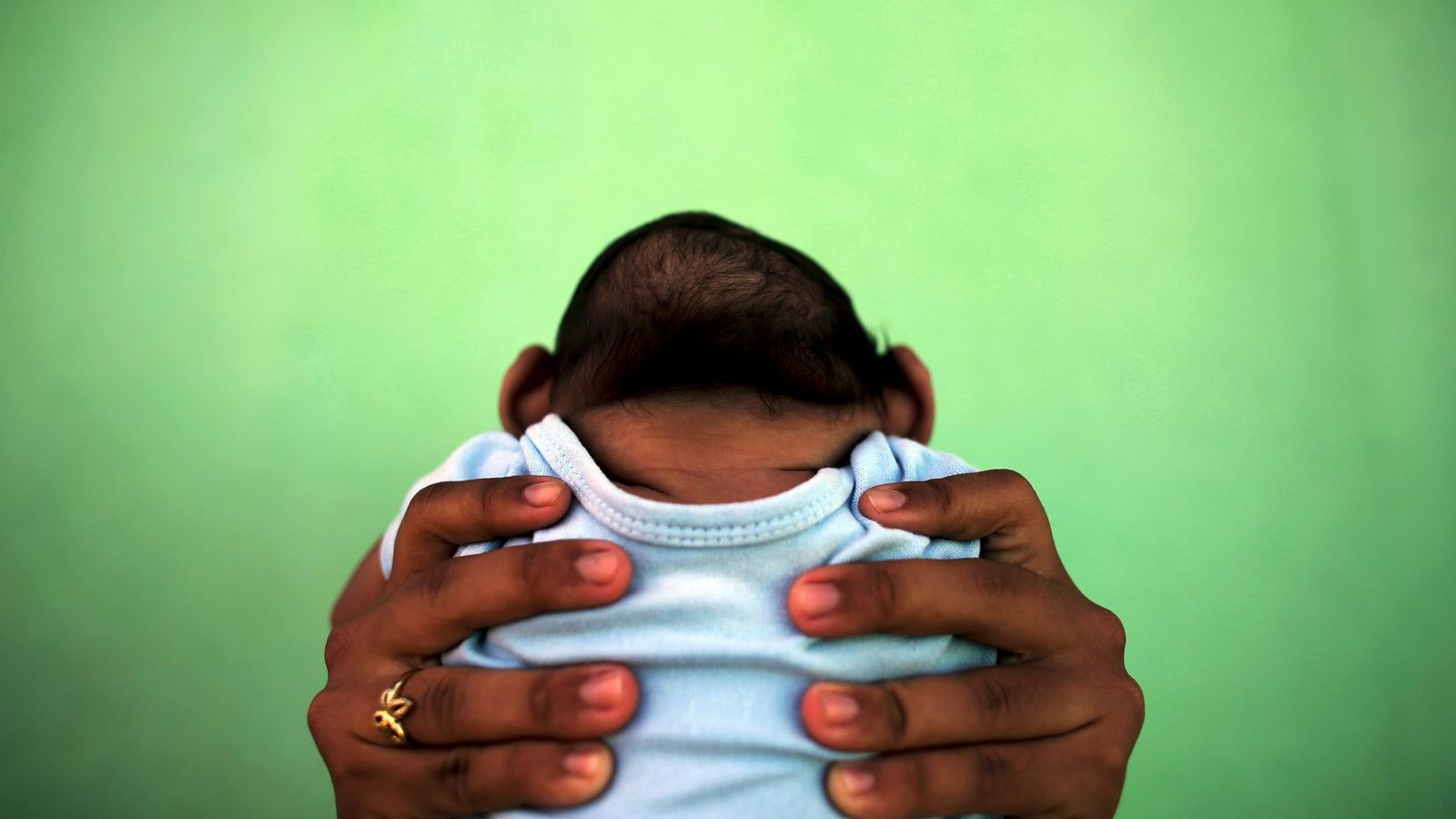 Foto: Imagen de un recién nacido afectado por el virus del Zika (Reuters).