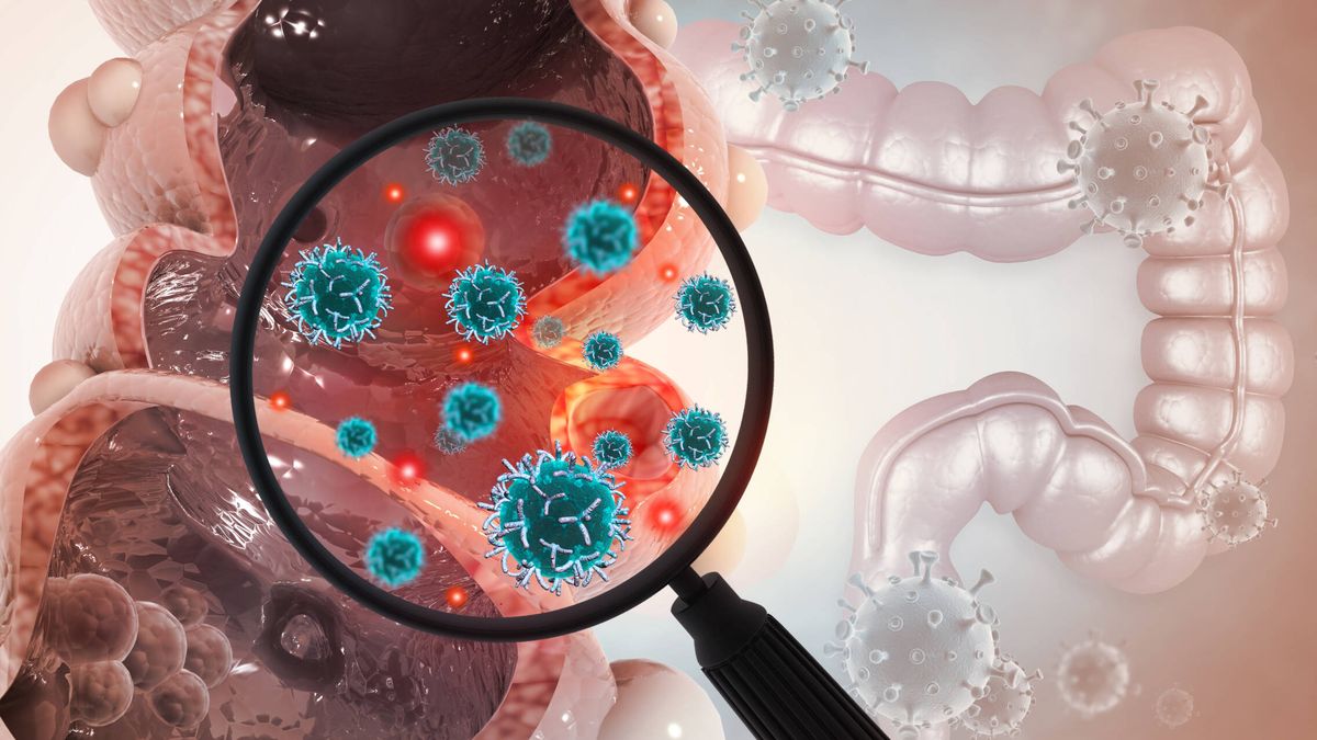 Las nuevas pautas para detectar el cáncer de colon: edad y tipo de prueba