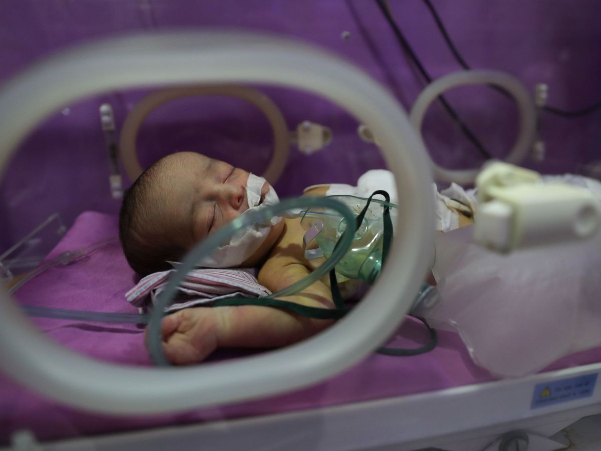 Foto: Un recién nacido en una incubadora. Foto: EFE MOHAMMED BADRA