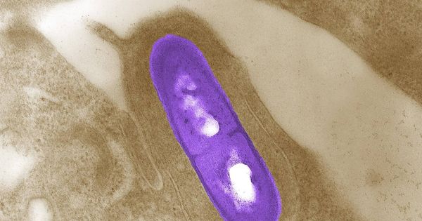Foto: Imagen microscópica de una bacteria 'Listeria monocytogenes'. (Reuters)