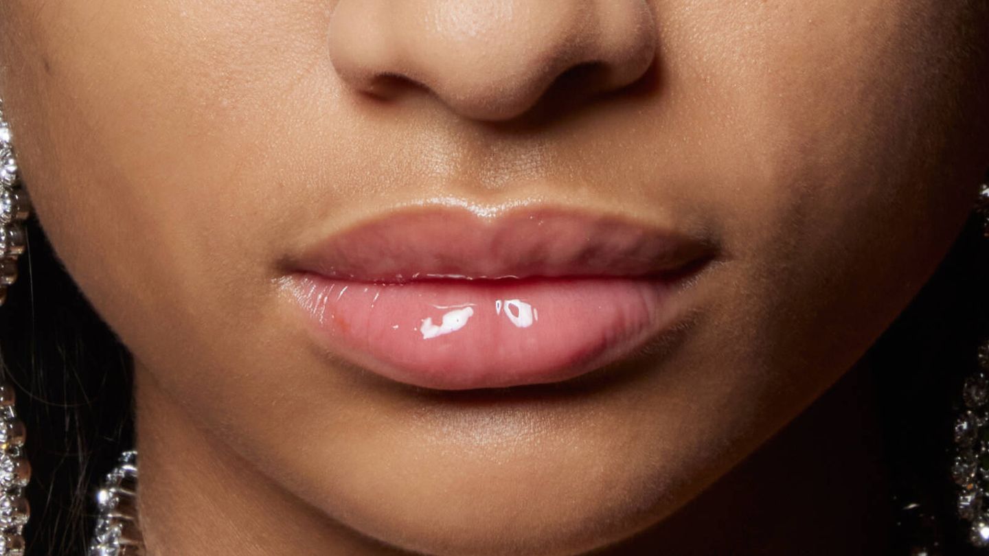 El relleno de los labios es uno de los retoques estéticos más habituales entre la gente joven. (Imaxtree)