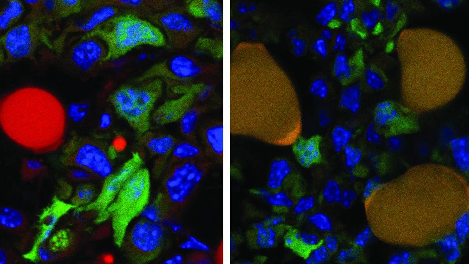 Foto: Las células tumorales (rojo) pasan a ser nódulos adiposos con el tratamiento. (Cancer Cell)