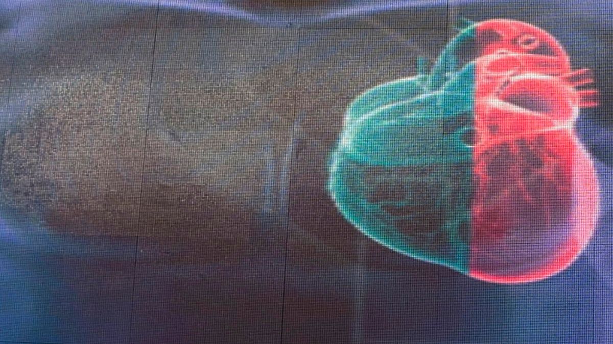 20.000 enfermos se podrán beneficiar de un nuevo fármaco para la insuficiencia cardiaca