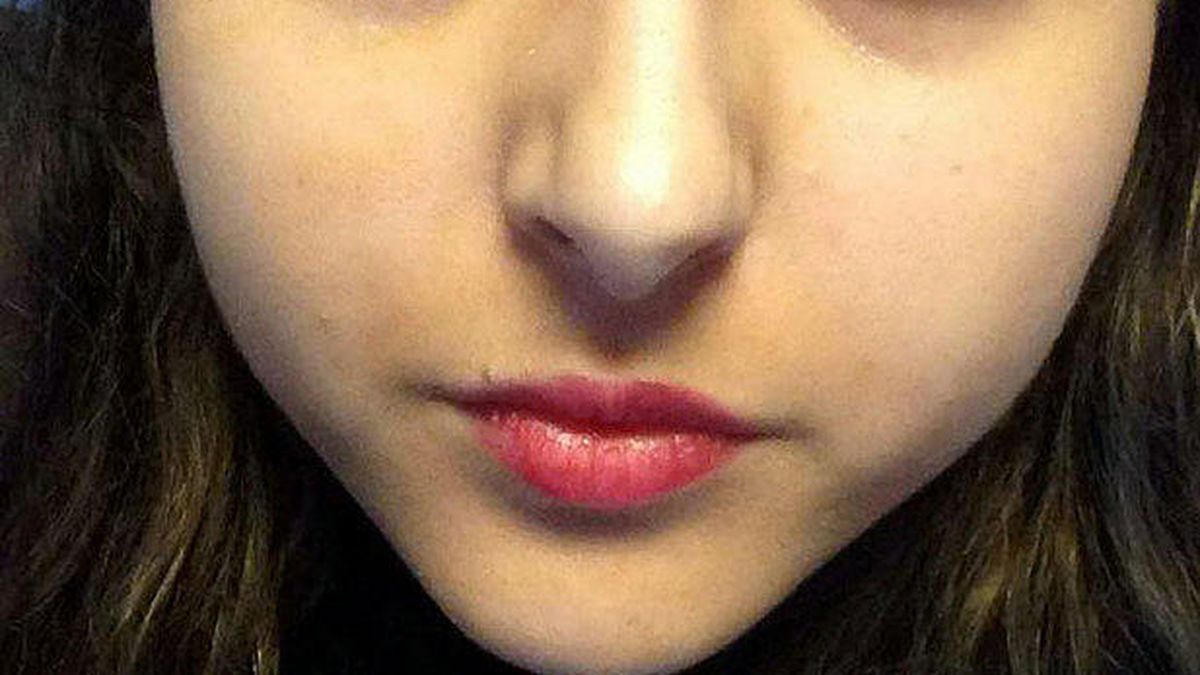 Una adolescente pasa una semana sin dormir para matar a un gusano en el ojo