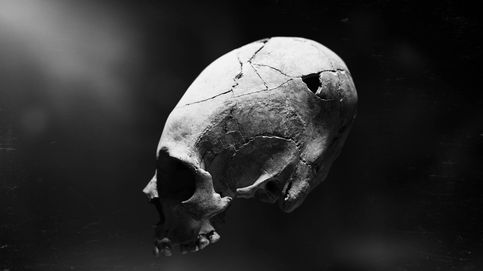 Así se trepana un cráneo: la historia de la lobotomía mucho antes del siglo XX