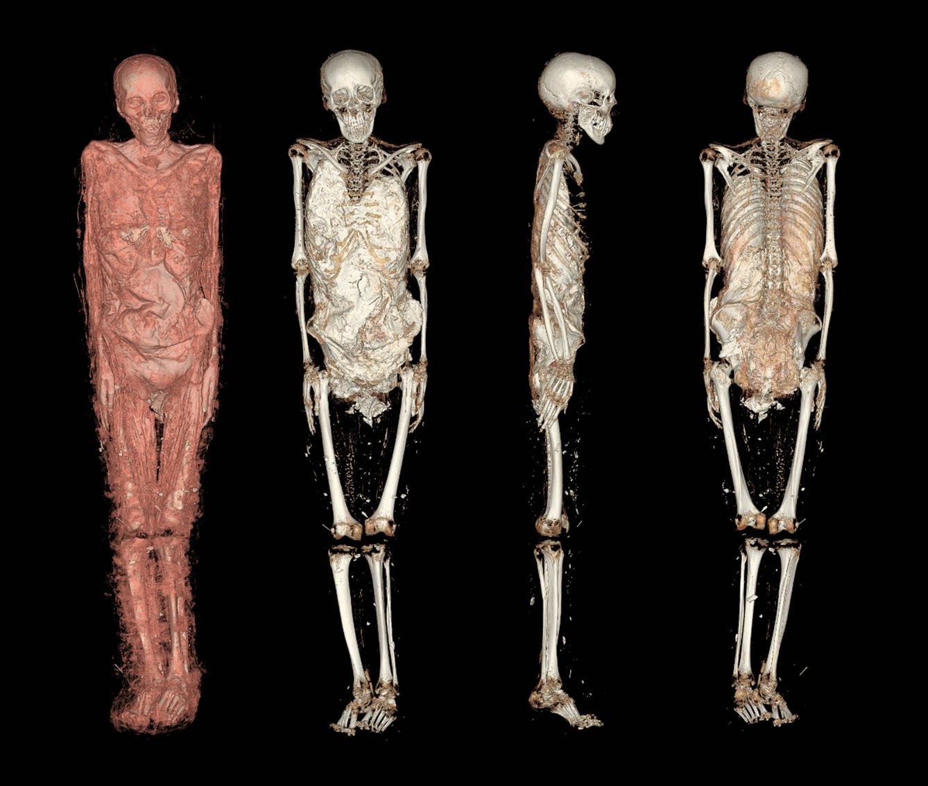 Reconstrucción tridimensional de la momia de la mujer joven (QuirónSalud/MAN)