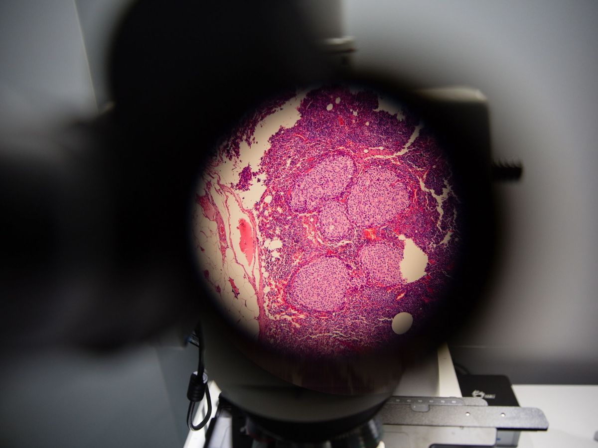 Foto: Un microscopio de realidad aumentada de Google AI para descubrir más fácilmente las células cancerosas. (EFE / Elijah Nouvelage)