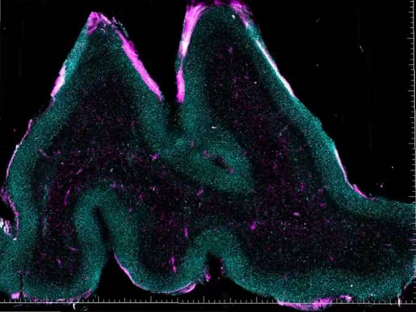 Análisis de la presencia de hormonas en la corteza prefrontal. (Chung Lab/MIT Picower Institute)
