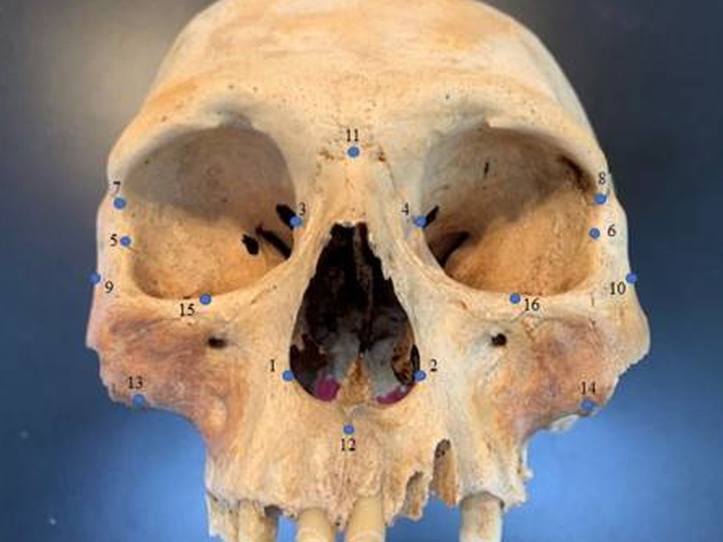 Uno de los cráneos de la investigación. Foto: Universidad Estatal de Carolina del Norte 