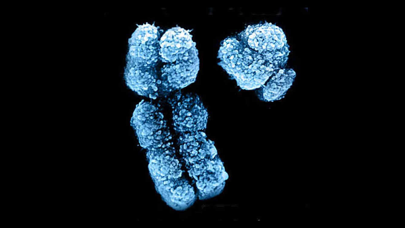 Foto: La desaparición del cromosoma Y puede generar nuevas especies humanas. (Whitehead Institute for Biomedical Research)