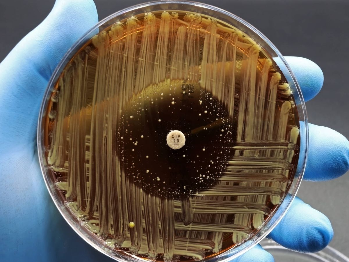 Foto: Cultivo de bacterias en una placa de laboratorio. (iStock)