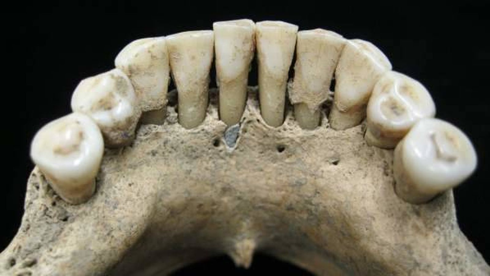 Foto: En el centro de la imagen, restos de lapislázuli hallados en la dentadura de una mujer de la Edad Media.