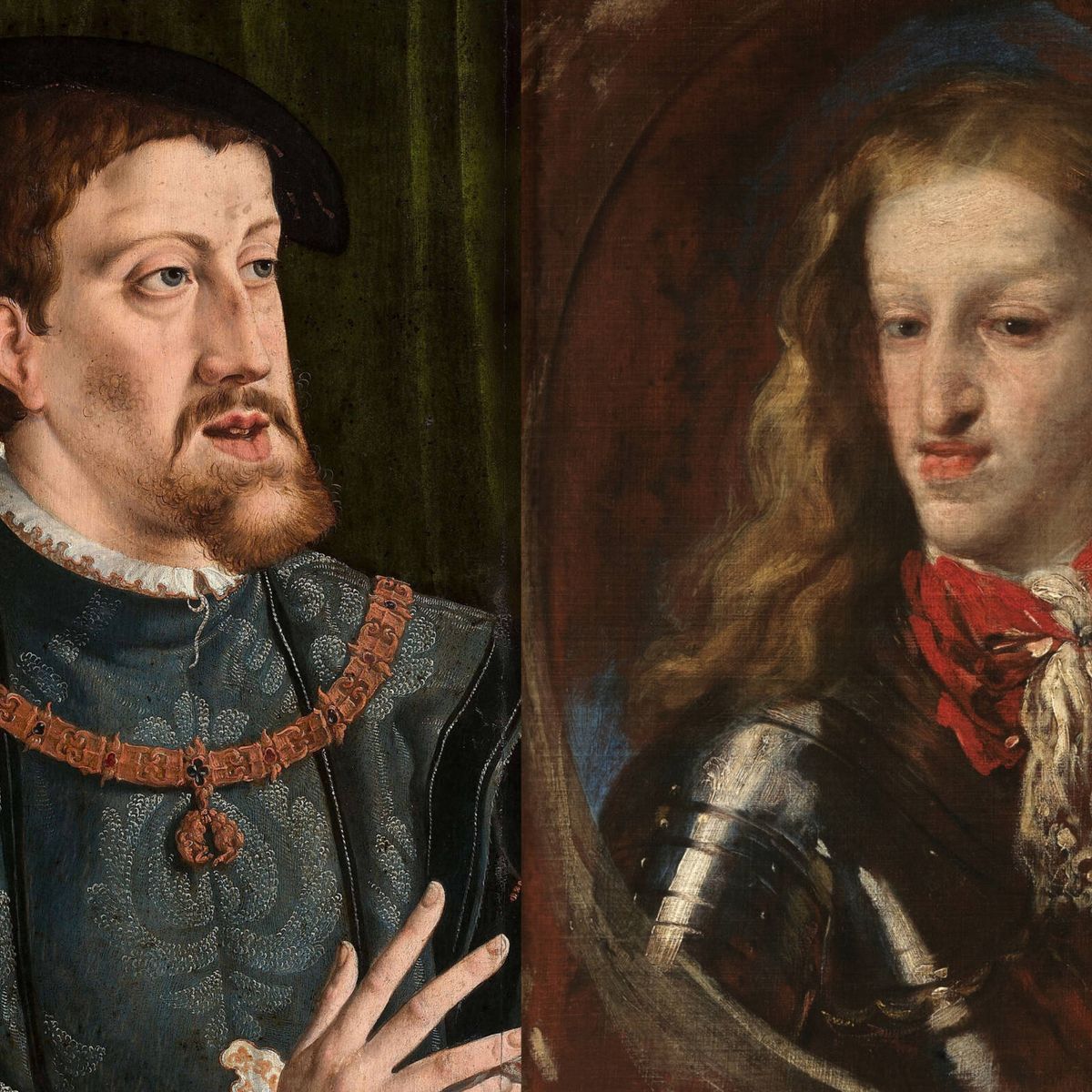 El prognatismo Habsburgo, la deformación que acomplejó a Carlos V