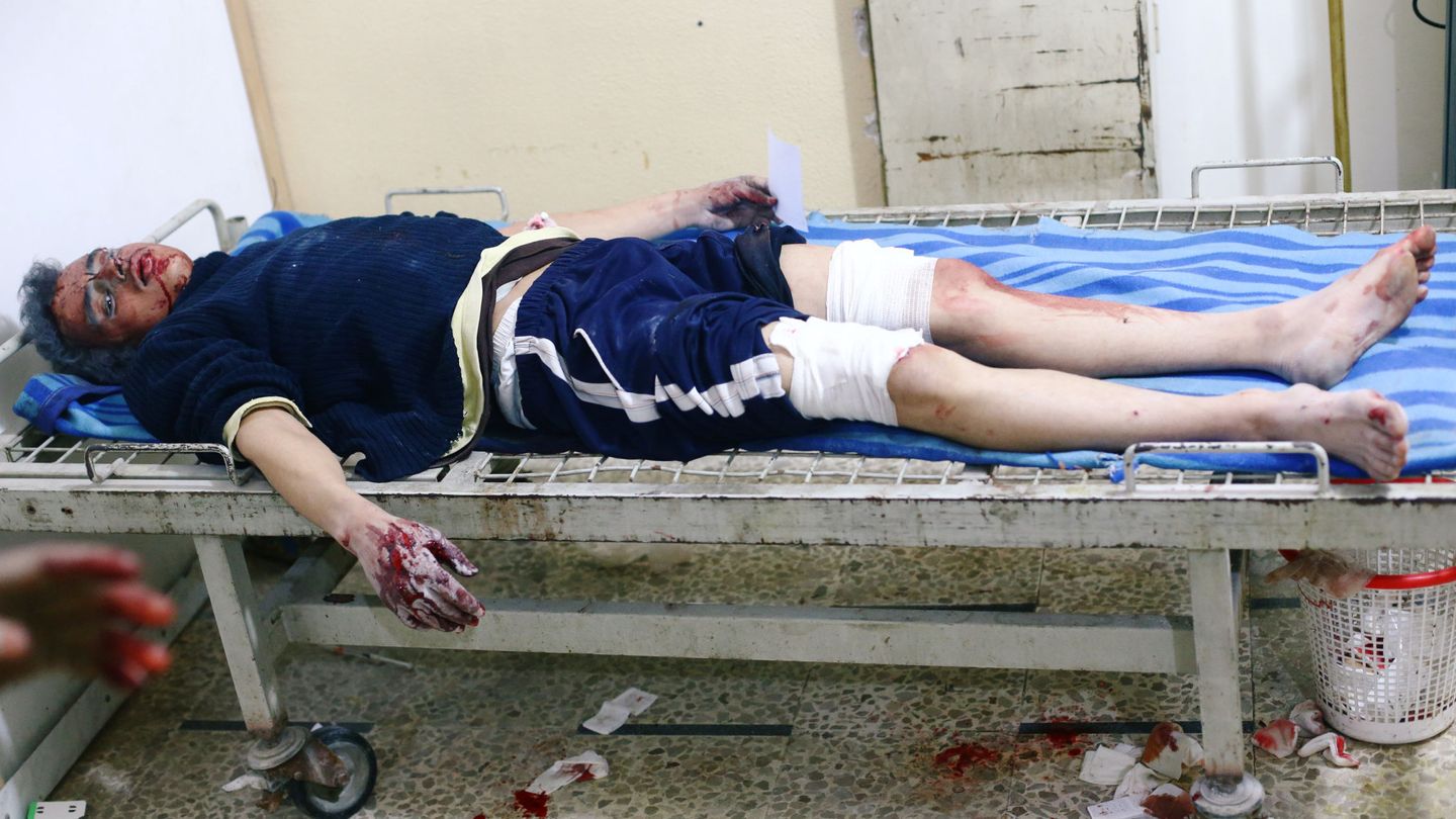 Un herido en una camilla en Duma. (Reuters)