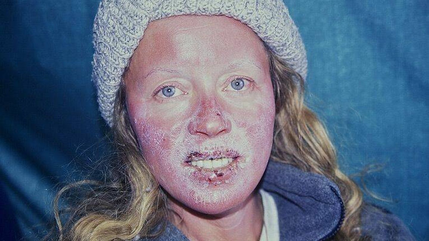La cofundadora de Pythom Space en una de sus aventuras polares, con la cara dañada por el frío
