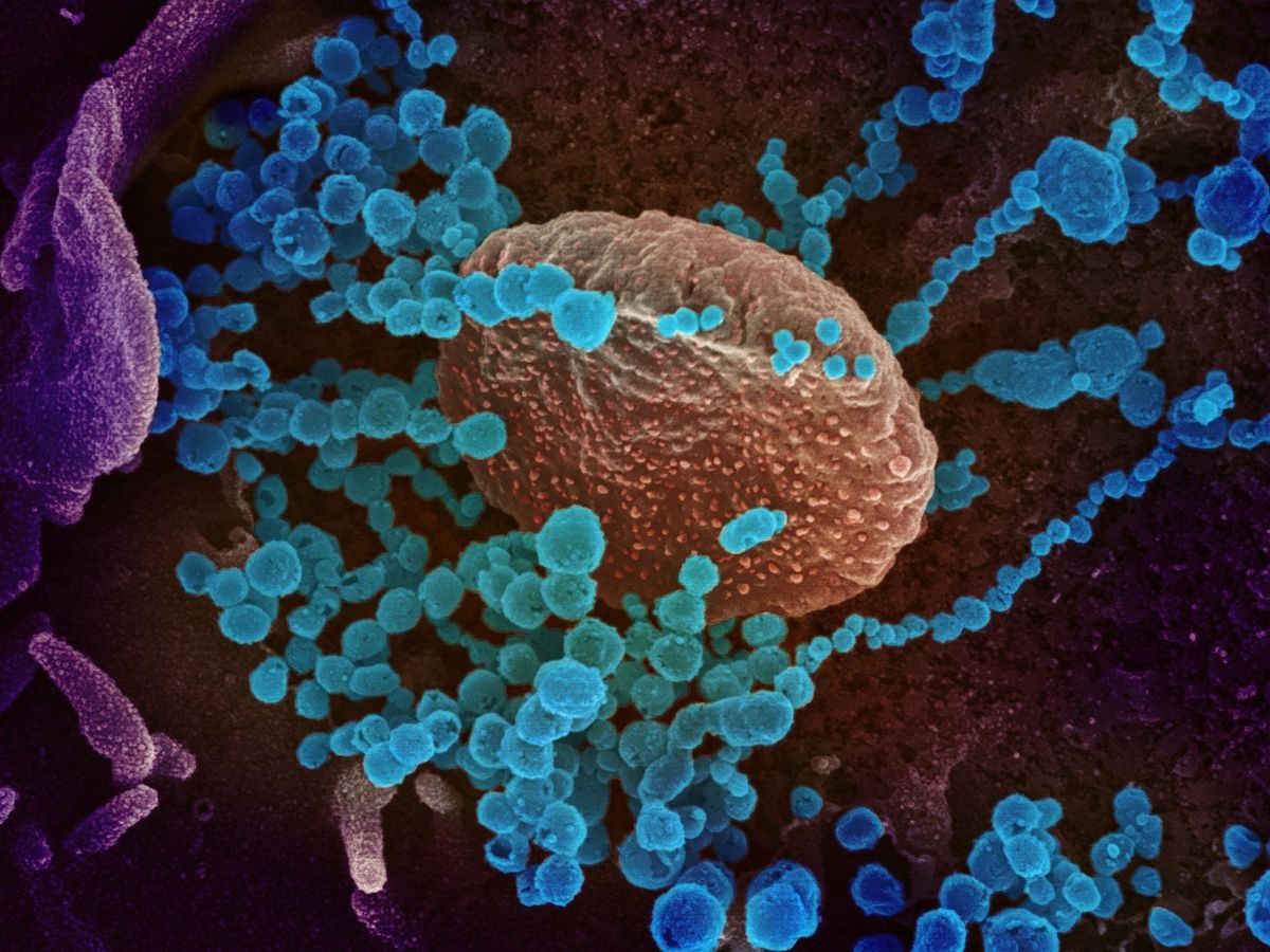 Foto: Una imagen de microscopio electrónico que muestra (objetos en azul) al SARS-CoV-2. (Efe)