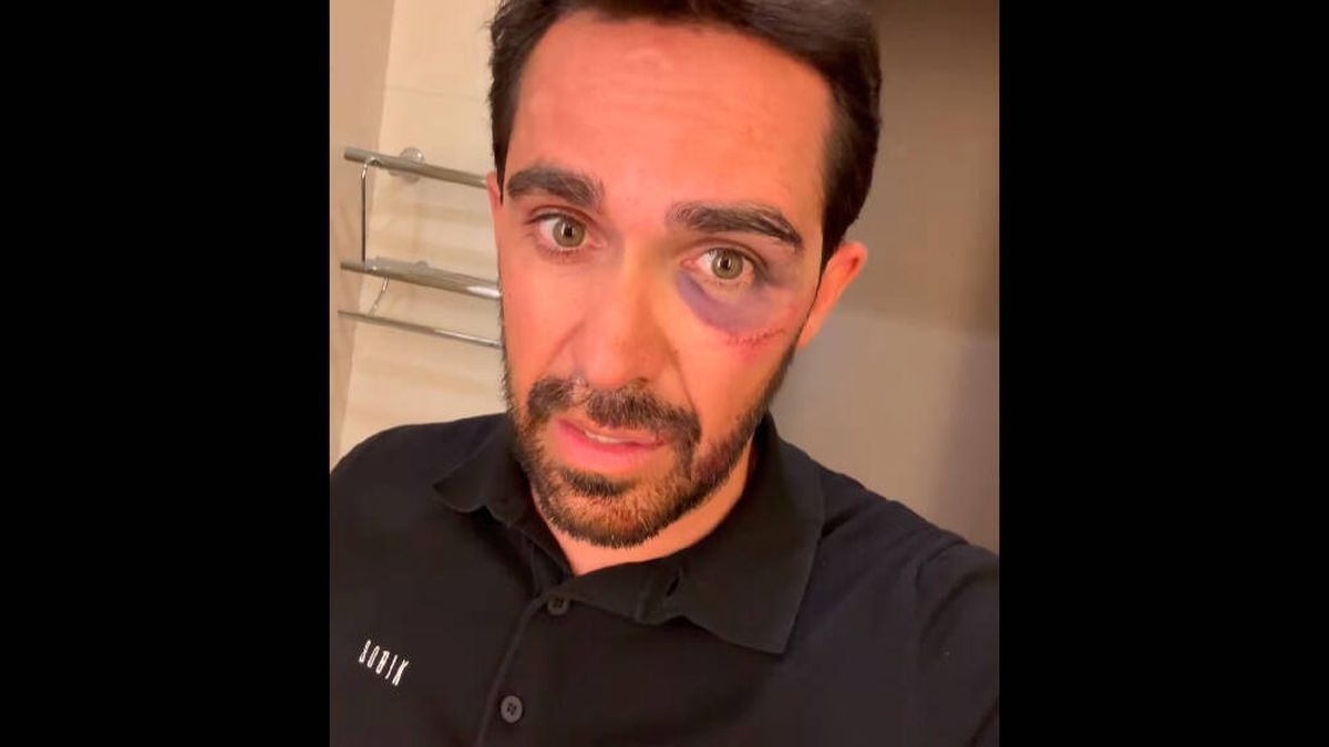 La dura caída de Contador en China: "Había muchísima sangre"