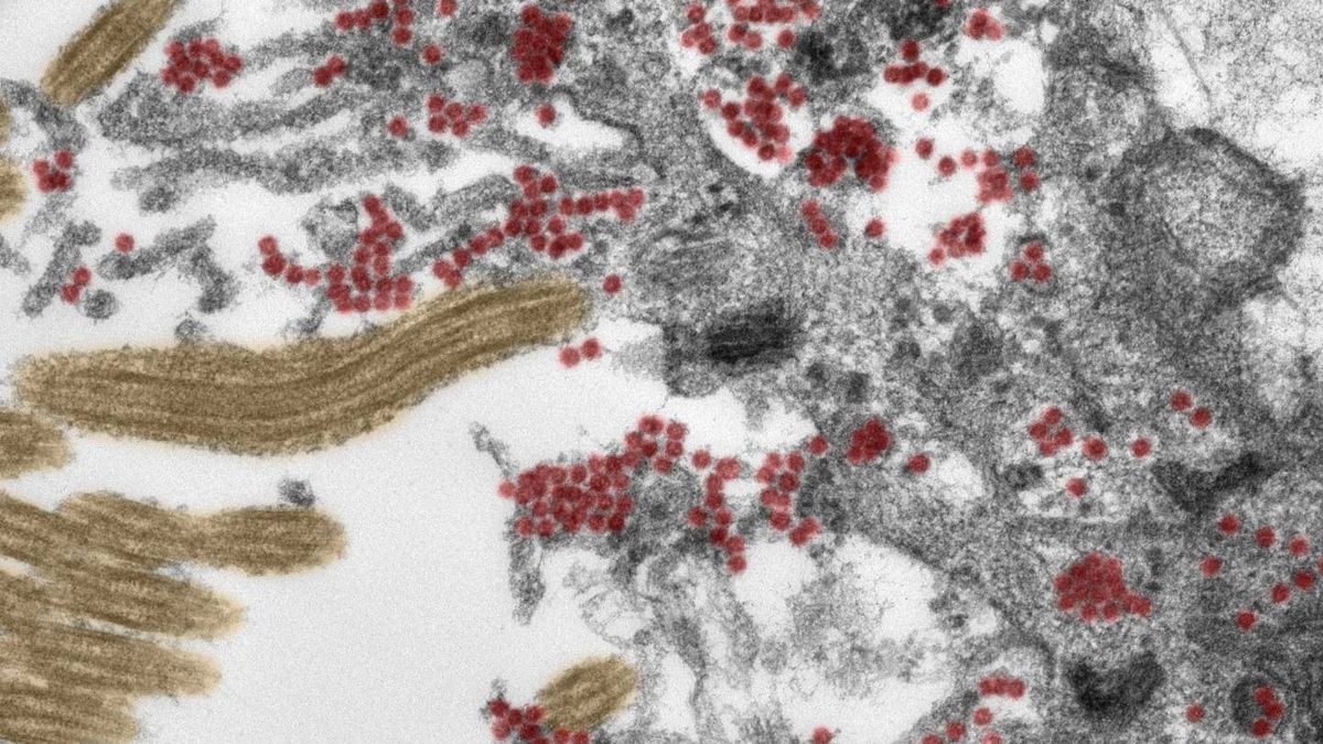    El coronavirus no es solo una enfermedad respiratoria: así es cómo se mete en tu cerebro