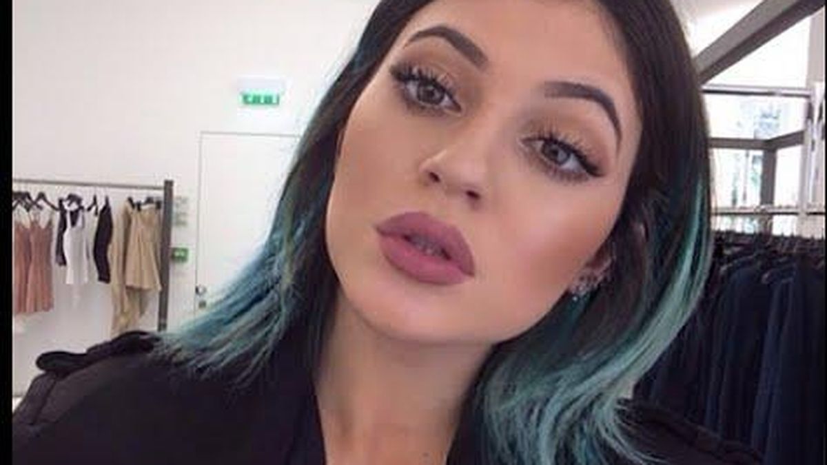 Twitter - Los seguidores de Kylie Jenner se deforman los labios para imitarla