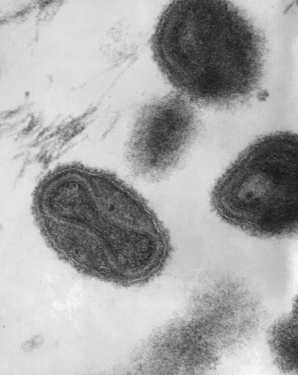 Imagen del virus de la viruela. (EFE)