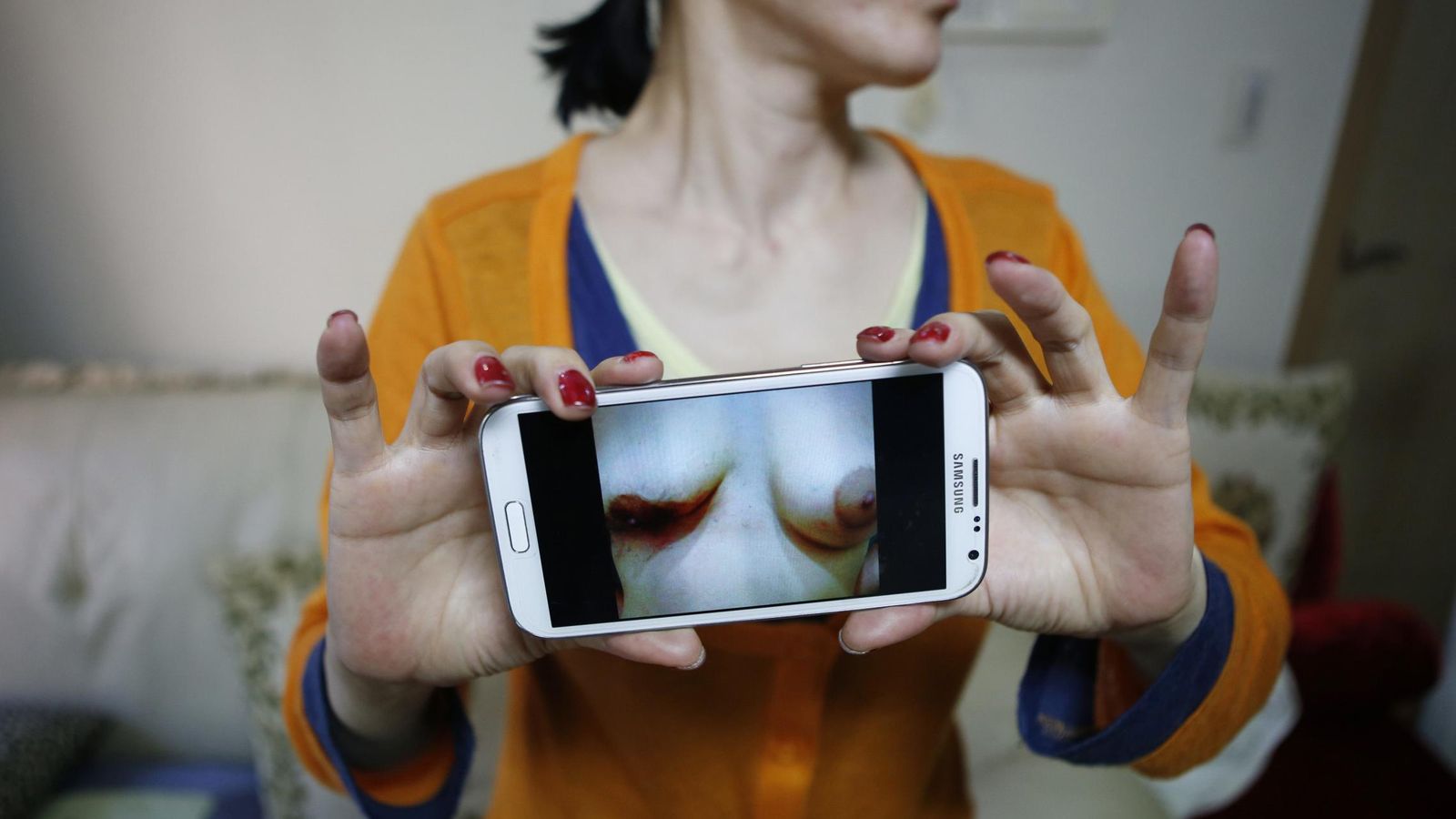 Foto: Una surcoreana muestra una fotografía de sus pechos tras someterse a una operación, en Seúl (Reuters).