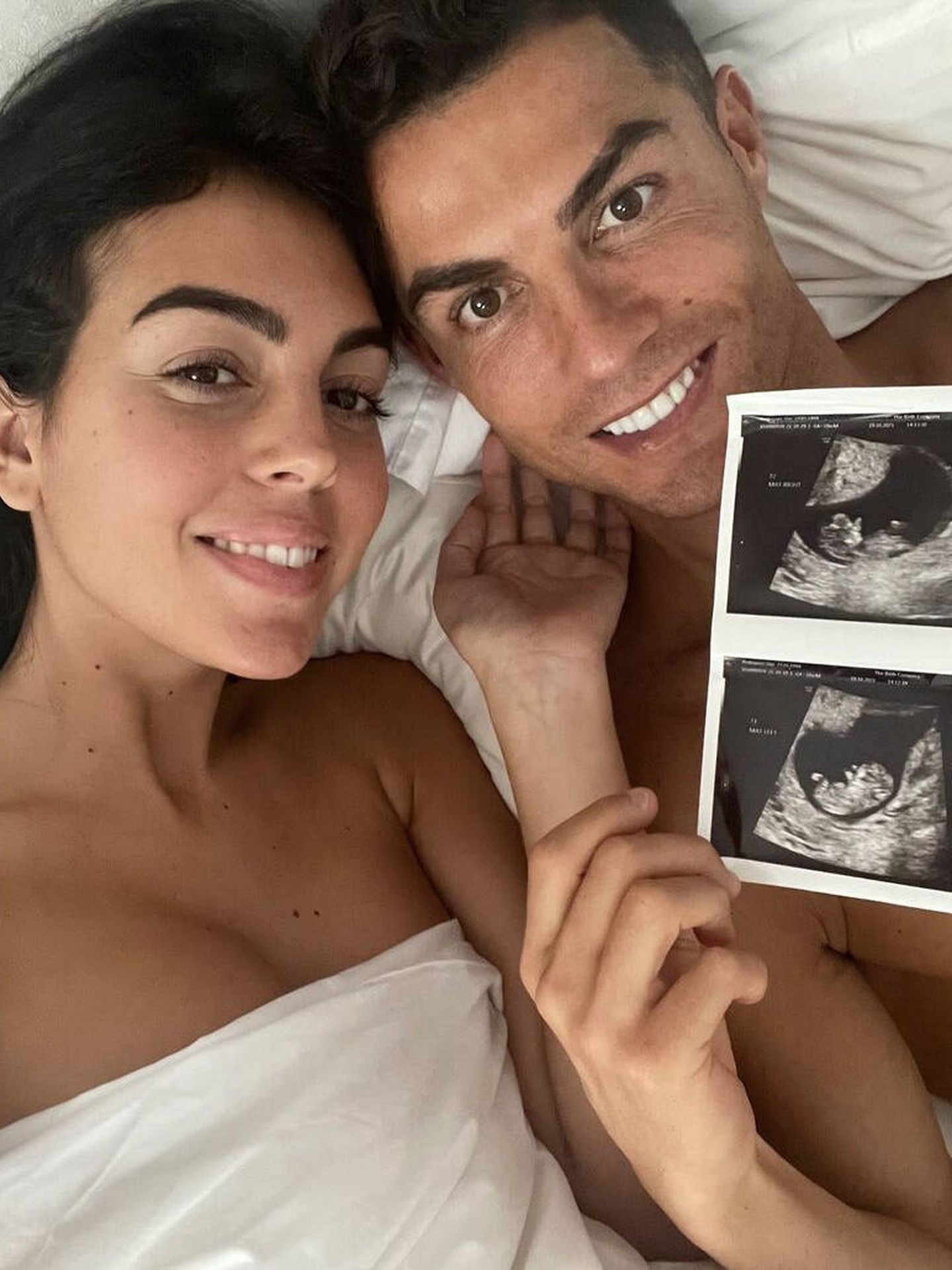 La pareja, anunciando que serán padres de gemelos. (Instagram @georginagio)