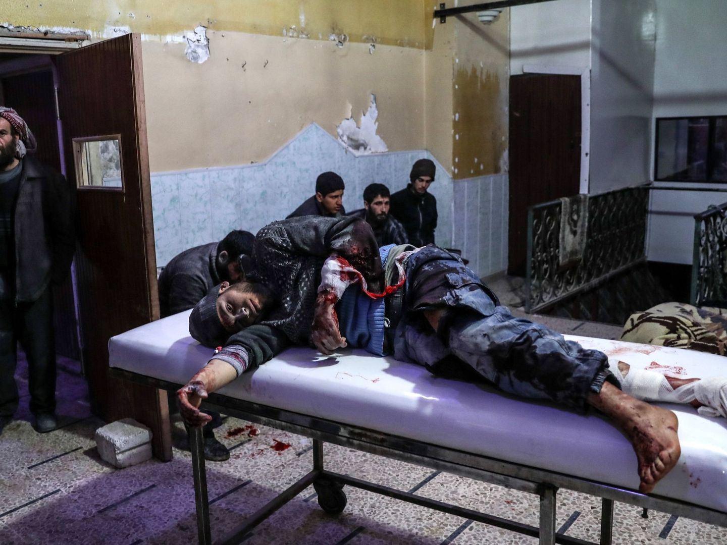  Un hombre herido tras un bombardeo al este de Guta es atendido en un hospital de Duma, en Siria. (EFE)