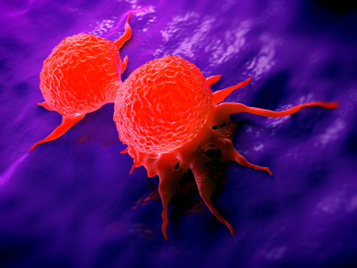 Foto: Una célula de cáncer de pecho dividida. (iStock)