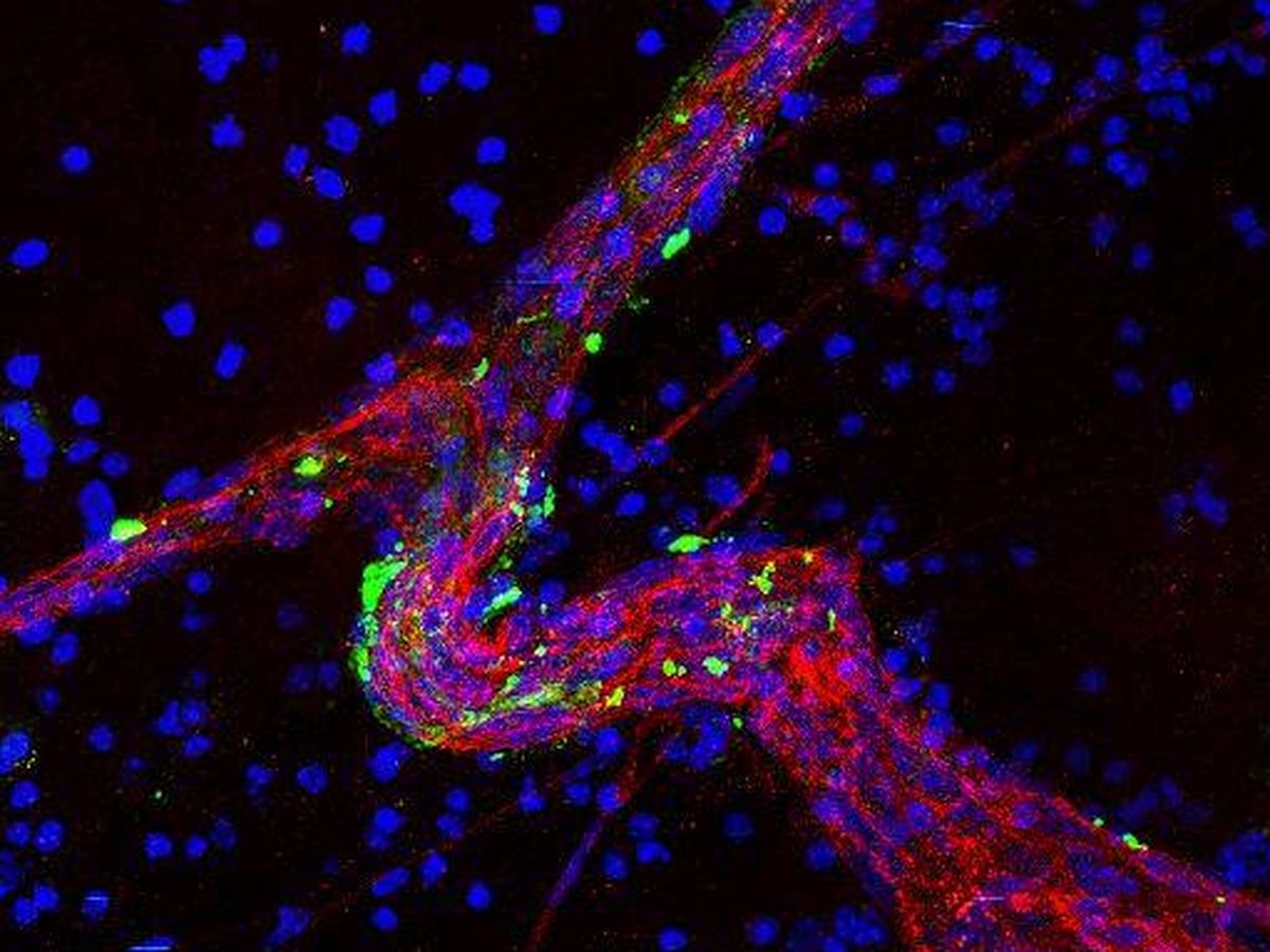 Foto: Vaso sanguíneo grande (rojo) en el tejido cerebral tratado con exosomas derivados de células metastásicas cerebrales (verde). Foto: David Lyden 