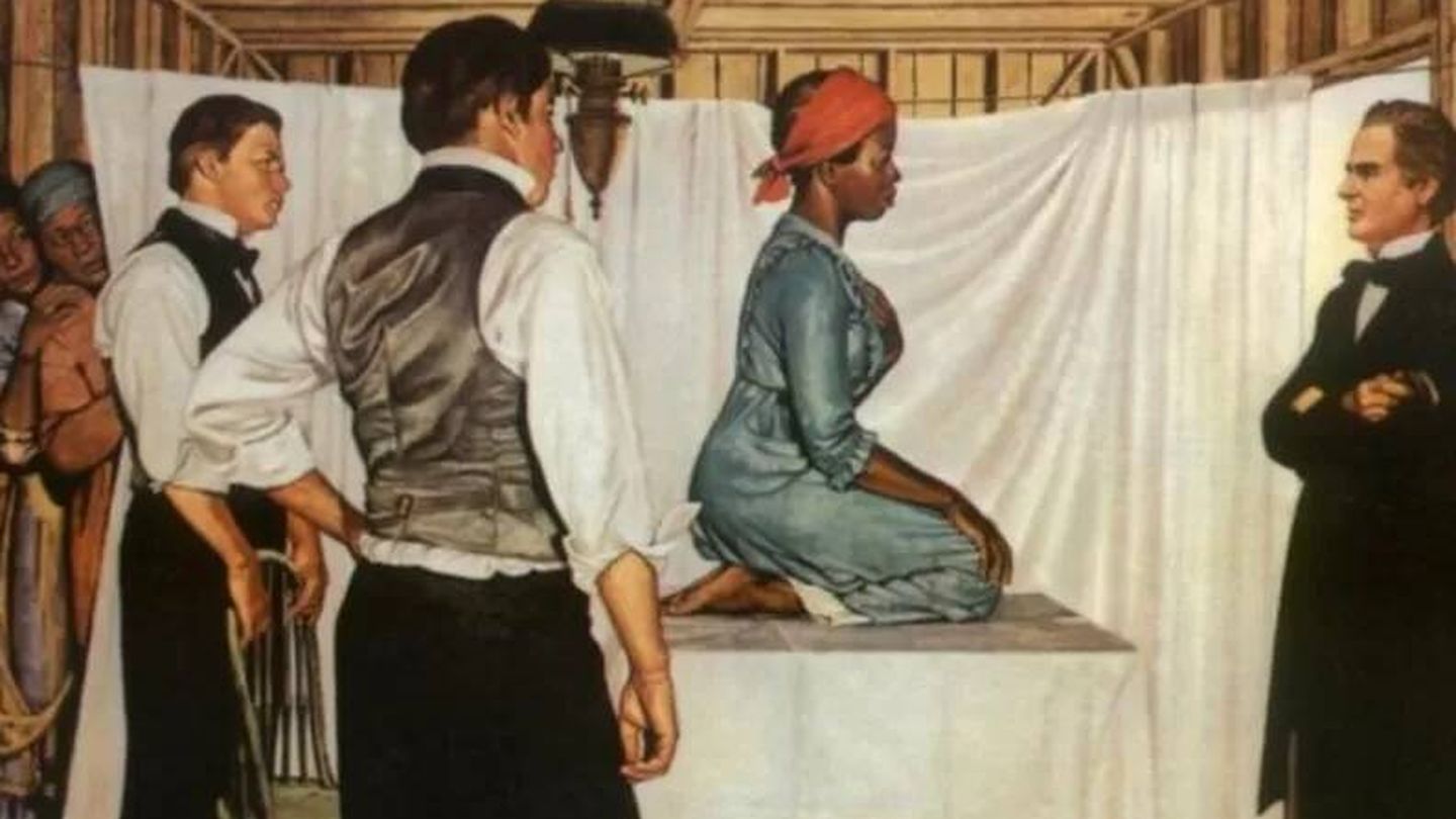Una de las ilustraciones que reflejaban cómo era el procedimiento llevado a cabo por Marion Sims. (Southern Illinois University School of Medicine)