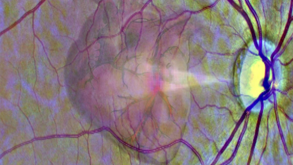 Un escáner de retina ve si puedes tener un infarto en el próximo año 