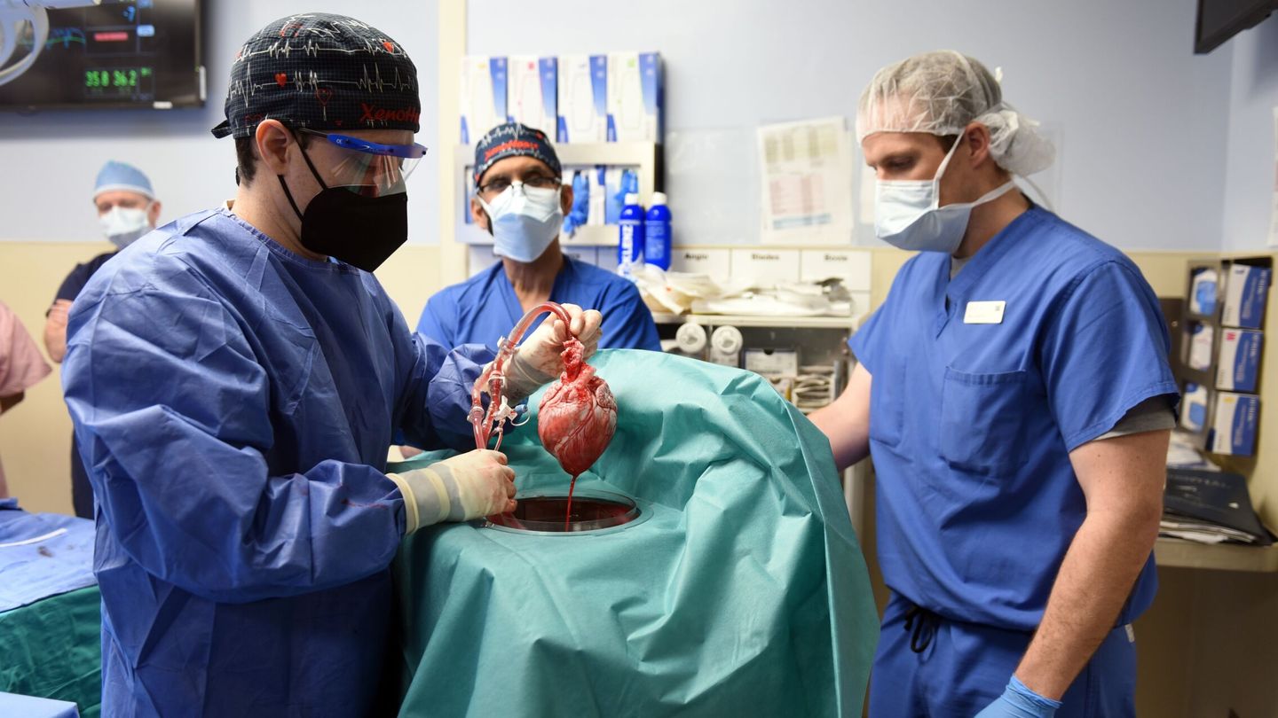 Cirujanos del Hospital de Maryland durante el trasplante de corazón de cerdo a un humano.