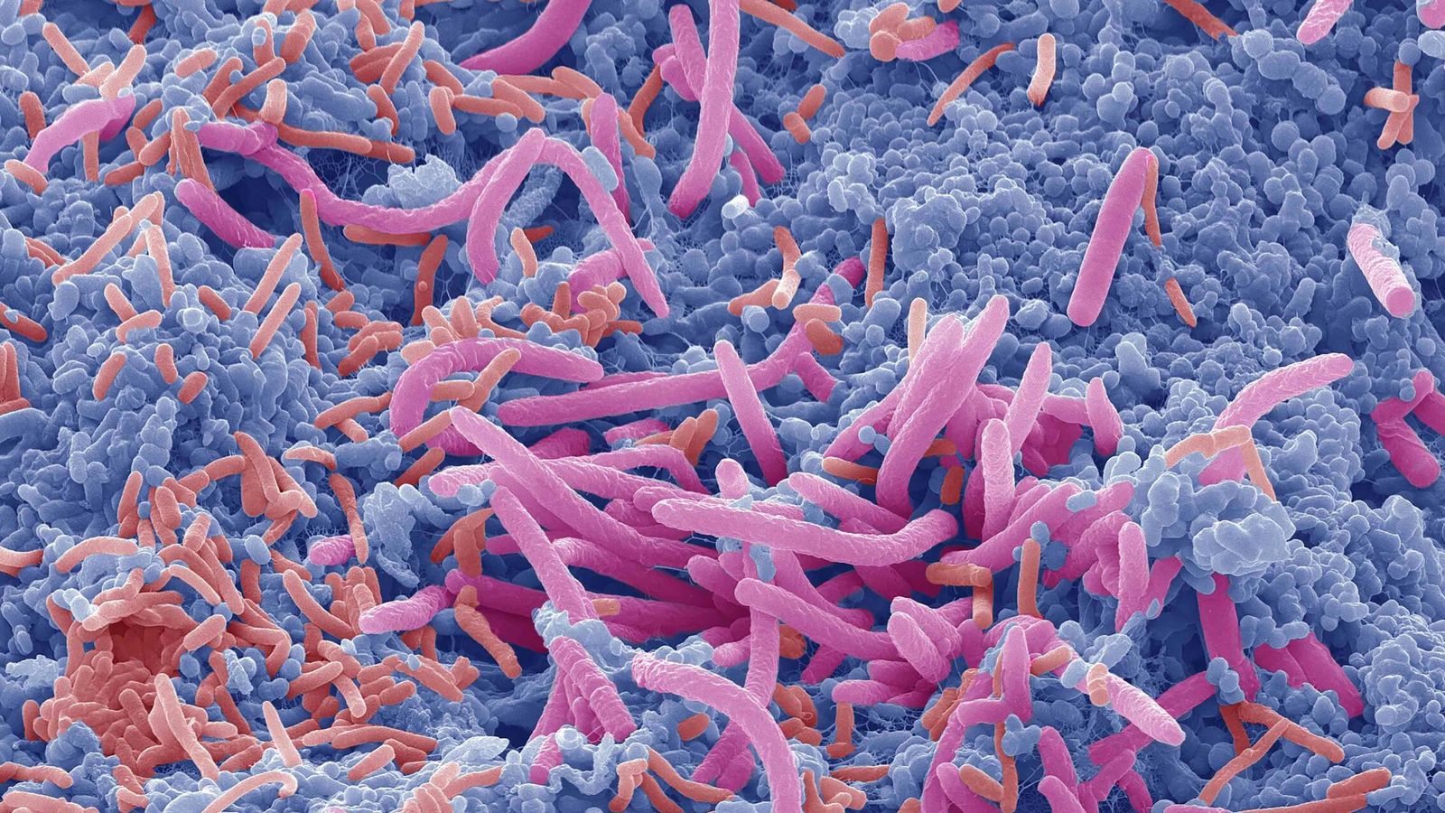 Reproducción de microbiota intestinal. (Science Photo Library)