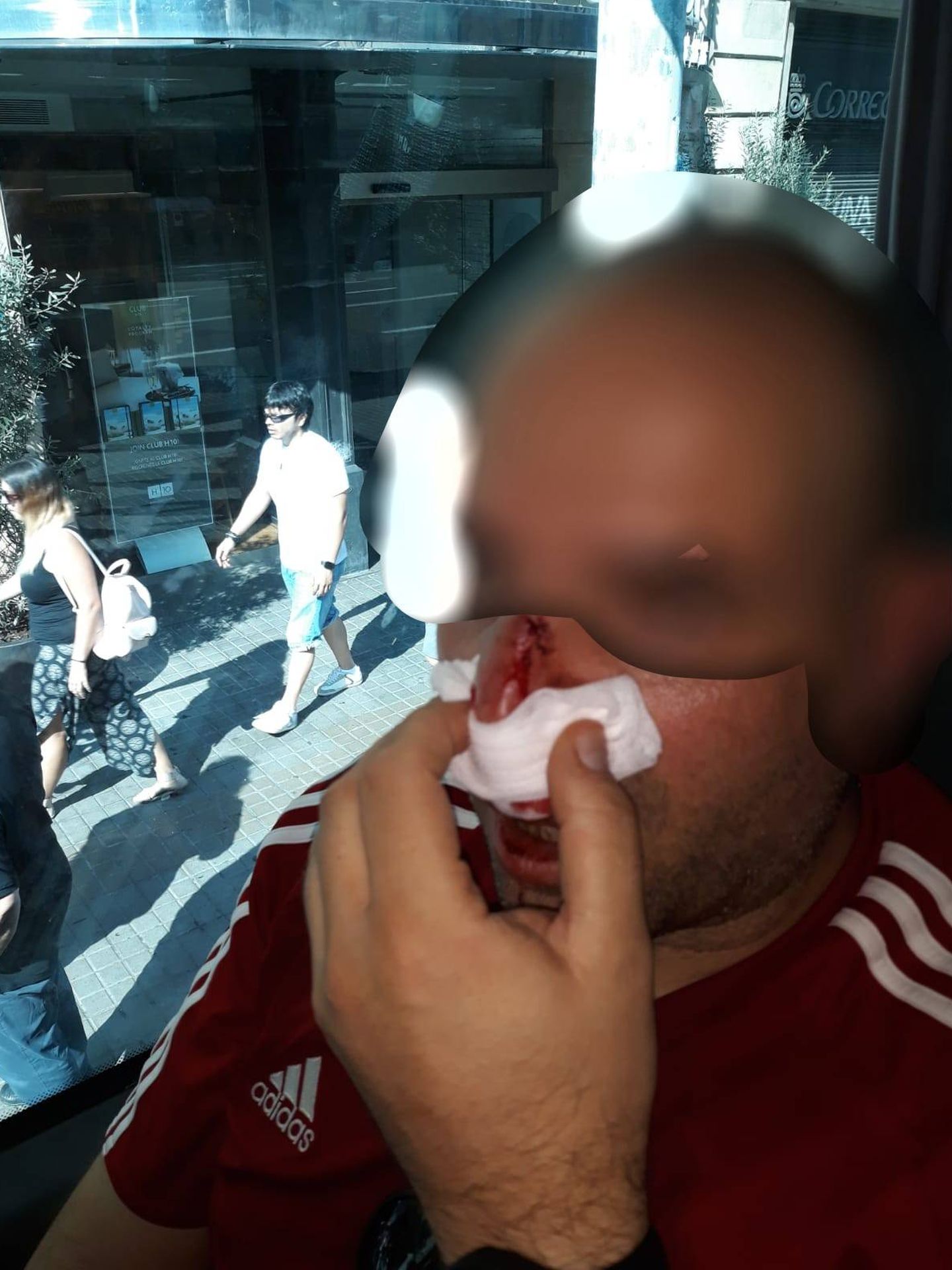 Agente de policía agredido en Barcelona por miembros del CDR. (Cedida)