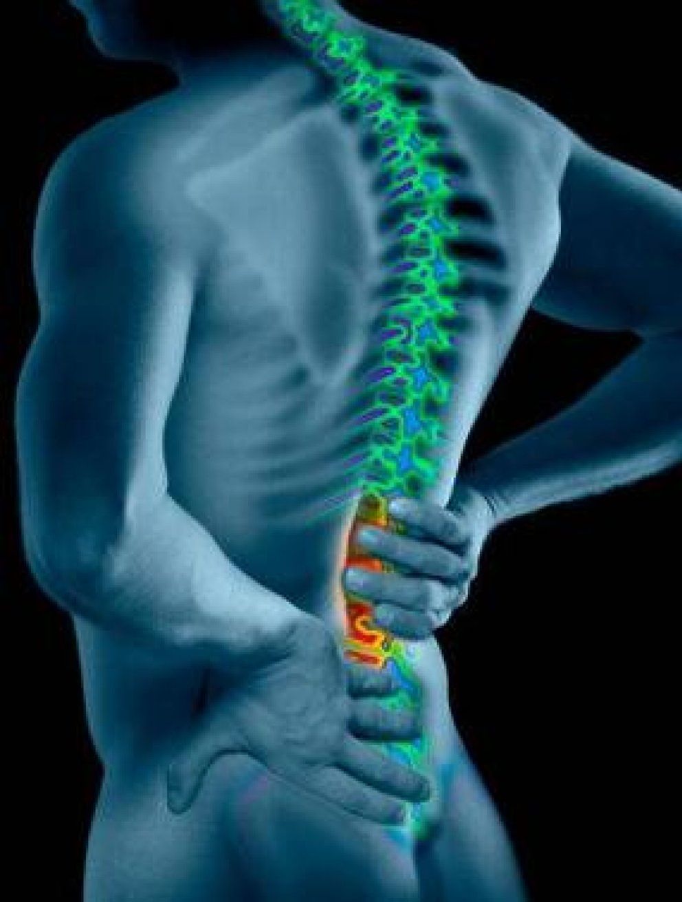 Foto: El 80% de la población sufrirá dolor de espalda en algún momento de su vida