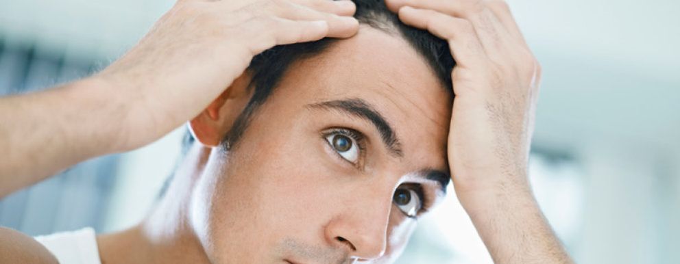Foto: Mesoterapia capilar, lo último contra la caída del cabello masculino