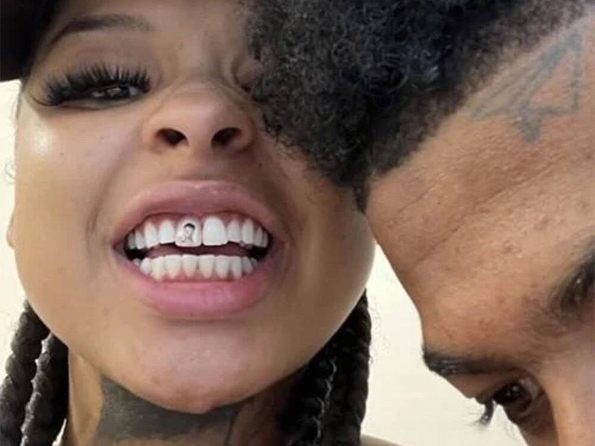 Foto: ¿Qué harías por amor? Esta 'influencer' se ha tatuado el rostro de su novio... ¡en un diente! (Instagram @chriseanrockbabyy)