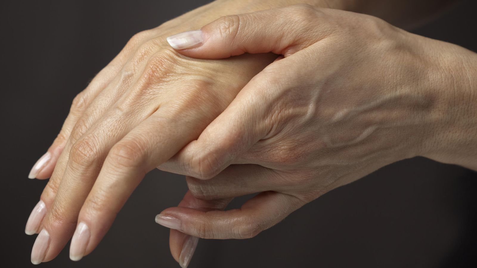Foto: La artrosis es una enfermedad degenerativa causada por el deterioro del cartílago articular. (iStock)