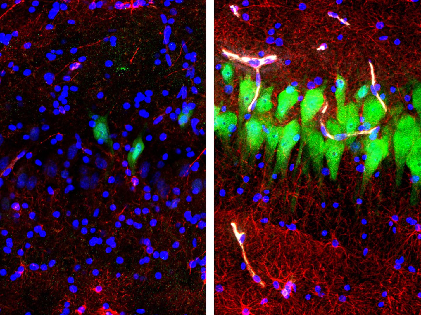 A la izquierda, el cerebro muerto de un cerdo; a la derecha, cómo se recupera la función cerebral. (Yale)
