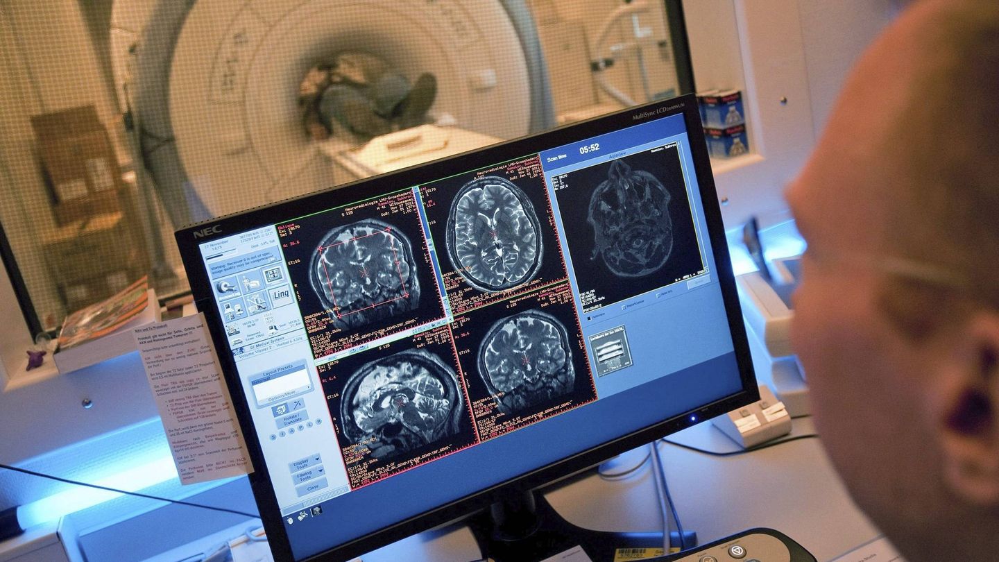 Imágenes de resonancia magnética del cerebro. 