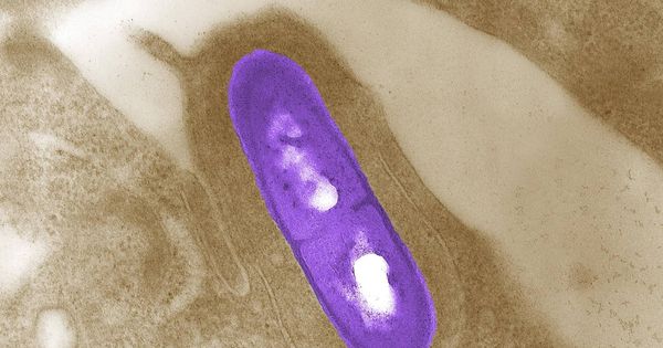Foto: Imagen microscópica de una bacteria Listeria monocytogenes. (Reuters)