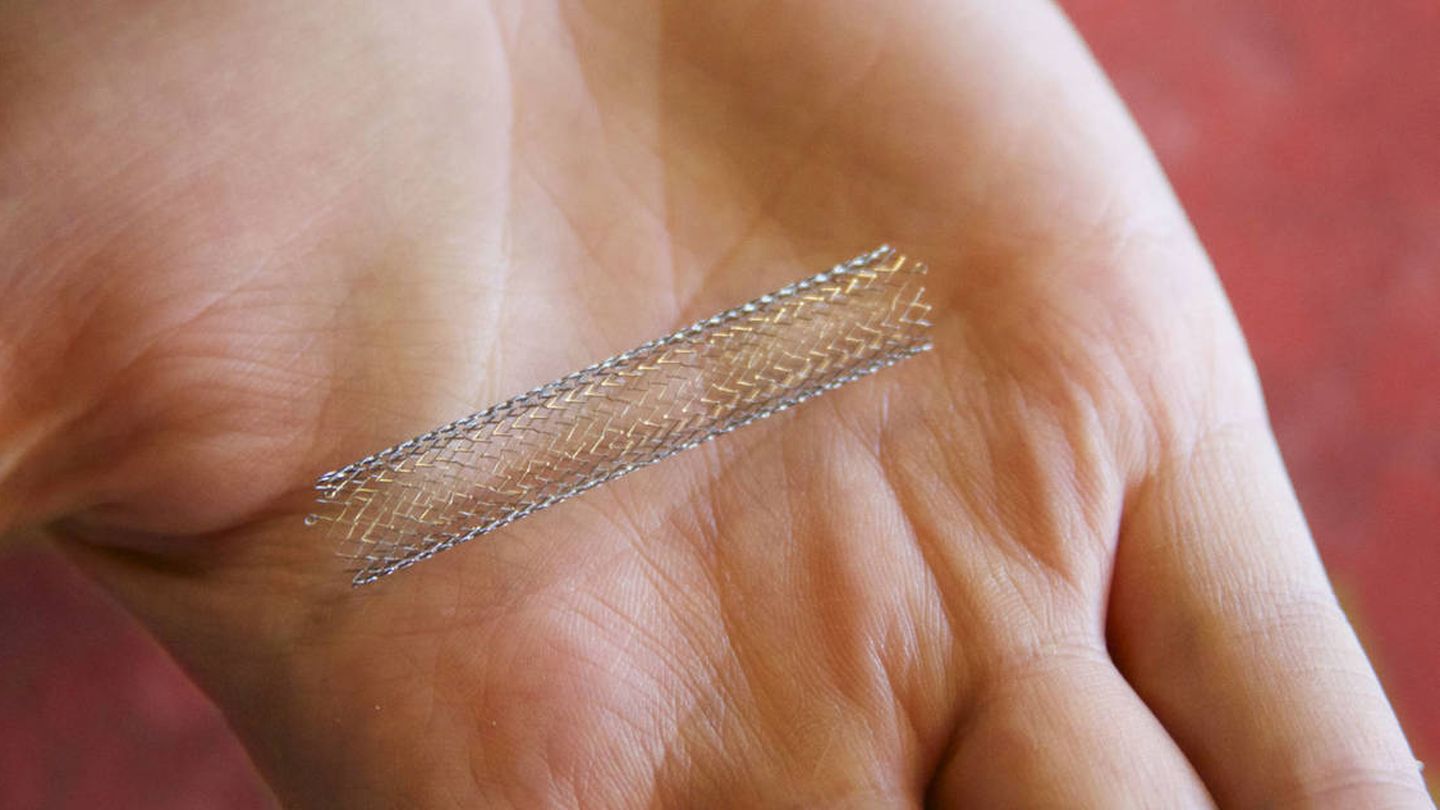 Un 'stent' metálico ya expandido. (Lenore Edman | Flickr)