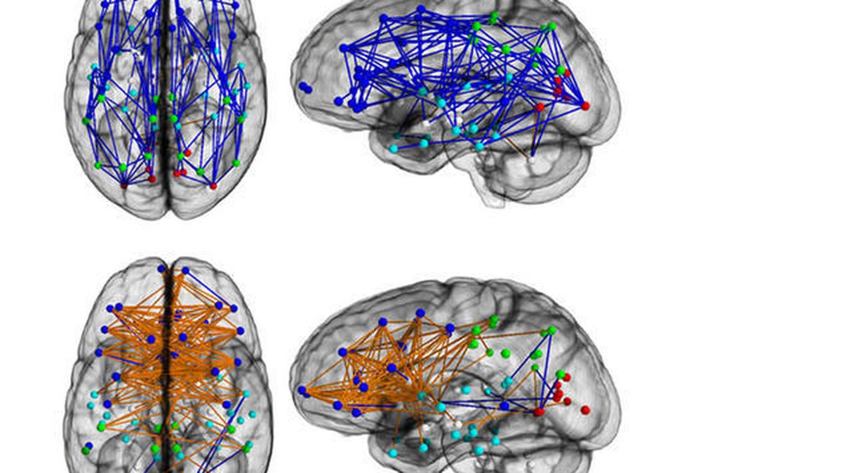 Los cerebros de hombres y mujeres se conectan  de manera diferente