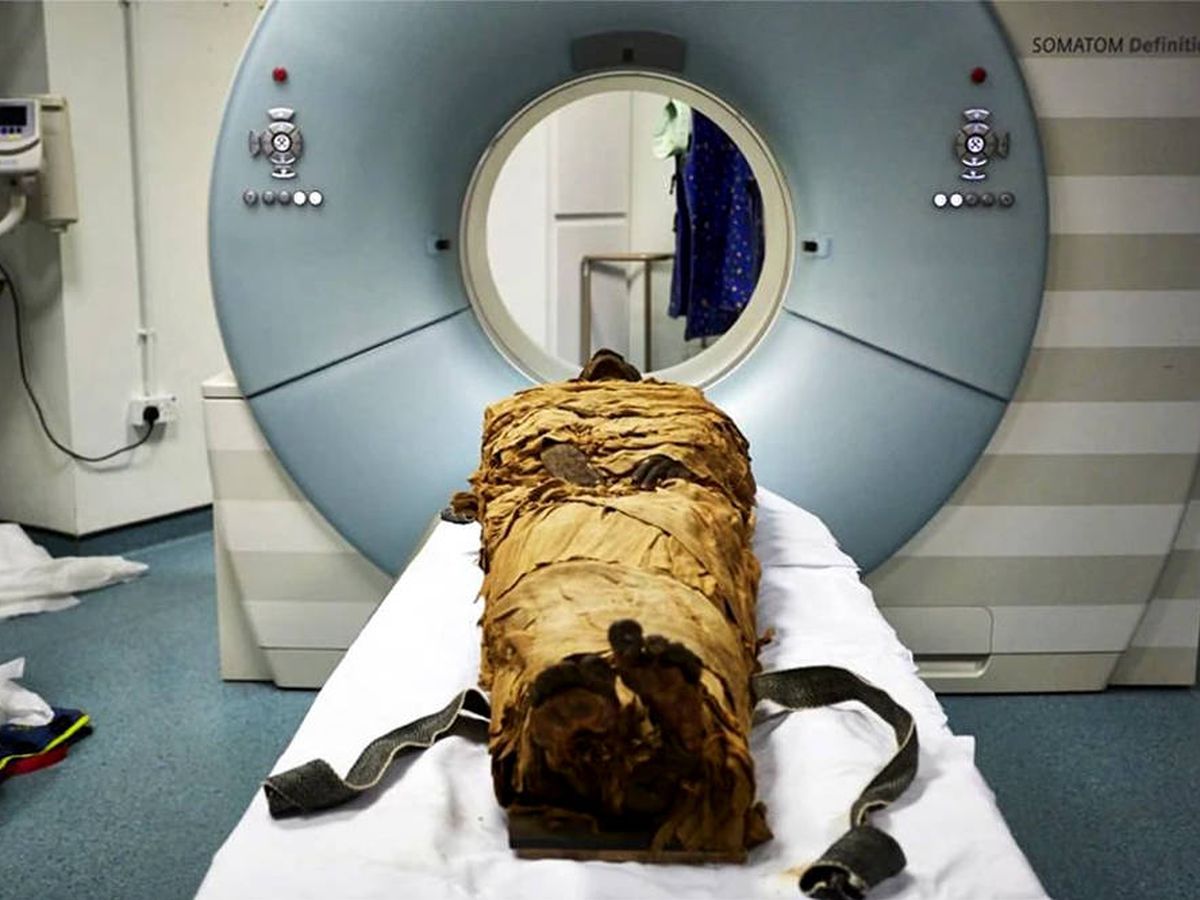 Foto: La momia fue sometida a escáneres médicos para poder recrear su tracto vocal en 3D (Foto: Nature)