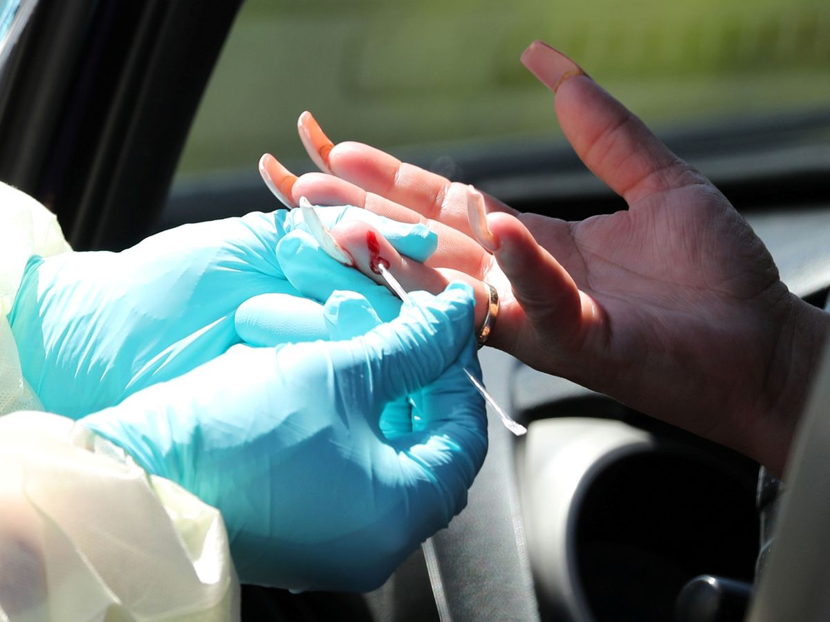 Foto: Prueba con un test rápido de anticuerpos con una pequeña extracción de sangre de un dedo. (Reuters)