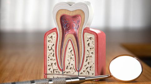La nueva causa que desconoces de la periodontitis  
